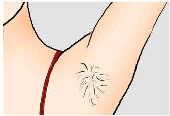 從毛茸茸到光滑如絲，最新脫毛價(jià)格指南，自信之旅啟程！