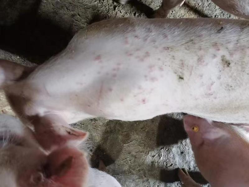 腎病綜合征最新指南論述詳解